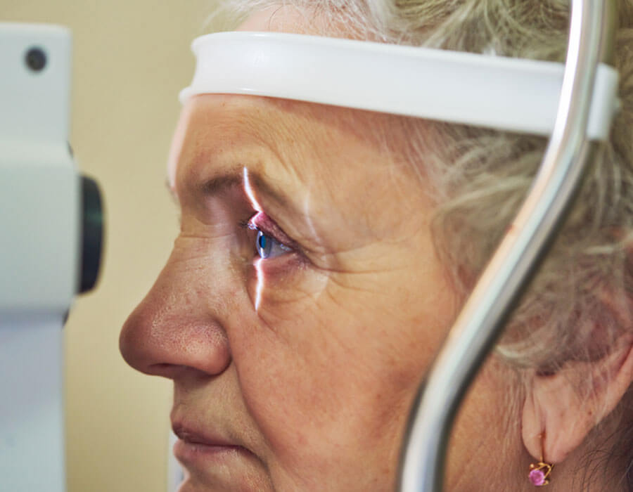 Glaucoma-Symptoms, Causes, Treatment