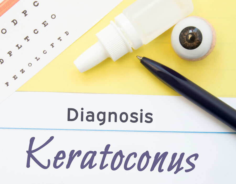 Keratoconus Treatment by Dr. Sridevi Haldar in OrthoVision Clinic banner